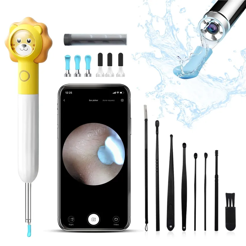XLife Q3 Yellow Ear Cleaning Otoscope with Camera, 1080p