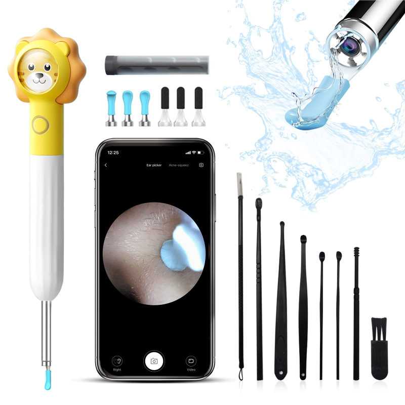 Otoscópio com câmera XLife Q3 Amarelo para limpeza de ouvidos, 1080p - Imagem 2